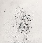 Albrecht Durer, Sele-Portrait with Bandage